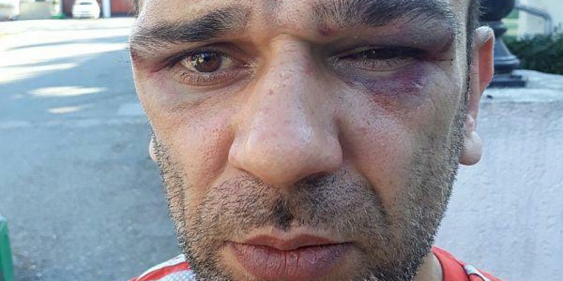 PSG osuđuje prebijanje Milana Blagojevića u Žitorađi i zahteva ostavku predsednika opštine