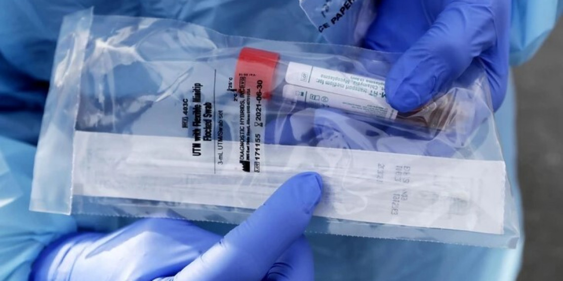 PSG – Hitno pokrenuti opsežno testiranje građana na Korona virus