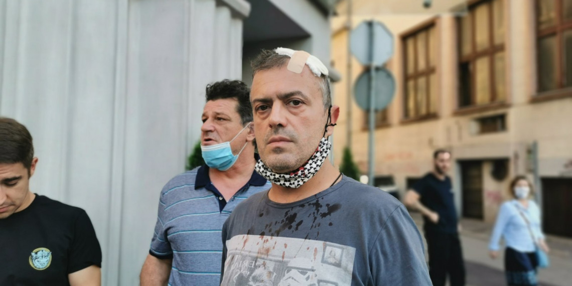 Napadnut Sergej Trifunović